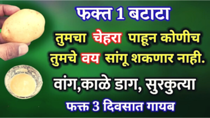 blemishes on your face